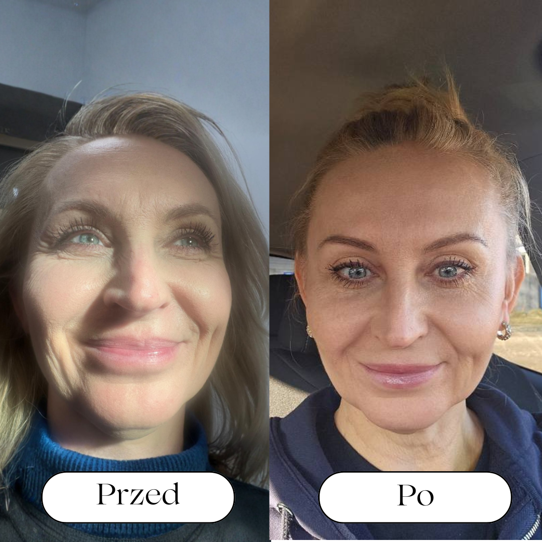 Kwas polimlekowy 💎